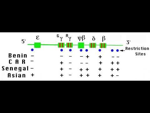 Senegal haplotype, Benin haplotype, Bantu haplotype Modifiers of sickle cell Disease