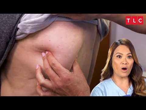 Dr. Lee Has Never Seen Skin Cases Quite Like These | Dr. Pimple Popper S1 & S2 | TLC India