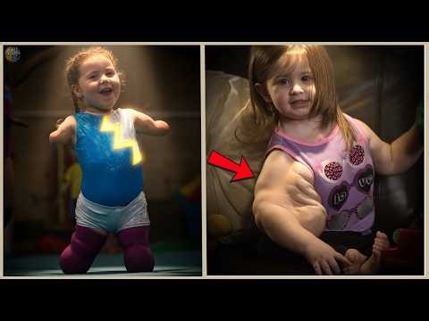 15 people born different who stunned the world – You have to see this - Rare People