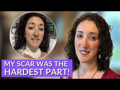 Anyone Can Get Cancer! | Cyndi’s Patient Story