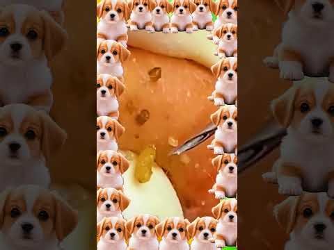 Blackheads Removal #655 | Acne Treatment and Very Satisfying Satisfying Pimple pop #blackheads