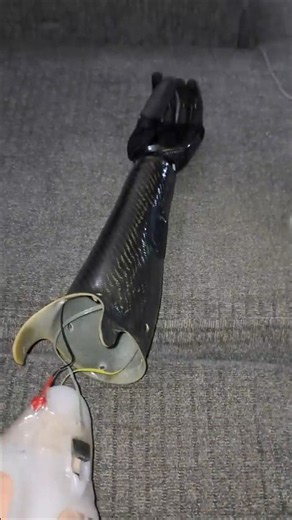 here's what the inside of my prosthetic arm looks like #bionic #prosthetics #foryoupage #fyp #fy