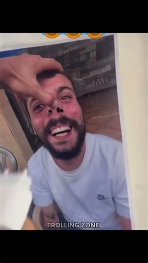 NOSE PLUG Prank 💀😂 #edit #trollface