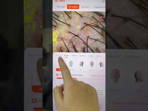 AI skin and hair analysis 2 in 1 detection device