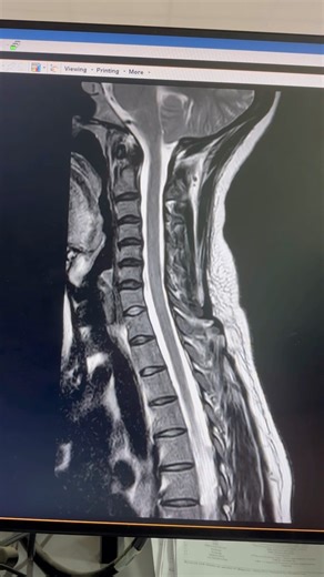 C spine क्या होता है? #viral #subscribe #funny #medicalimaging