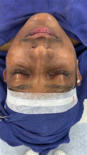 Jaw surgery