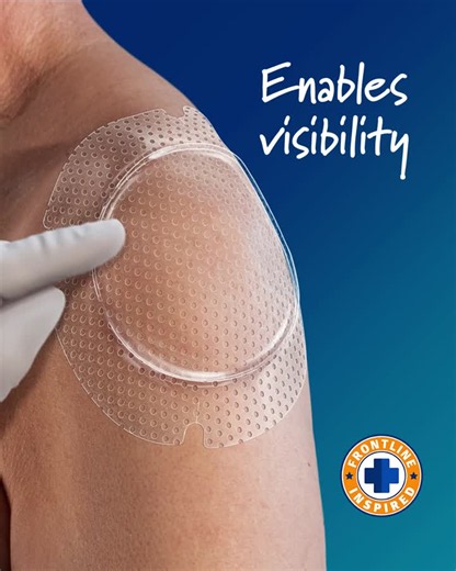 Designed with nurses in mind: The story behind OptiView® | Madeline Murch