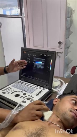 #carotiddoppler #colourdoppler #pwdoppler #vascularimaging #ultrasound #dopplerultrasound #ultrasoundtechnology #emp | Md. Shaharia Shawon