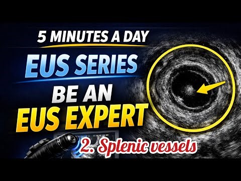 Splenic Vessel Navigation in EUS: Scope Techniques & Doppler Differentiation