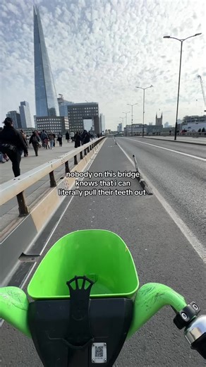 Wisdom Teeth Removal - Dentist's Perspective