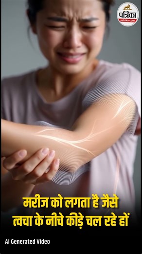 त्वचा के नीचे कीड़े चलने का एहसास? | Morgellons Disease