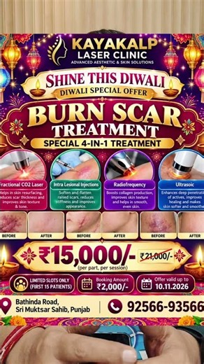 Diwali Offer 2026 | Acne Scar & Burn Scar Treatment