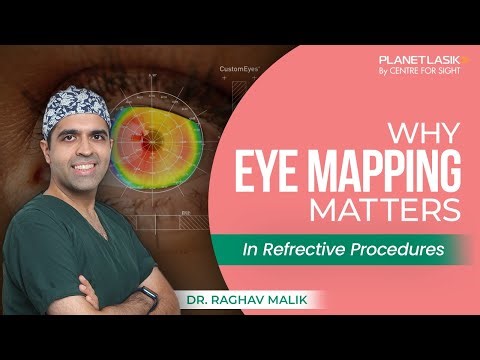 Why Eye Mapping Is a Crucial Step Before LASIK | Customized Vision Correction | Dr Raghav Malik