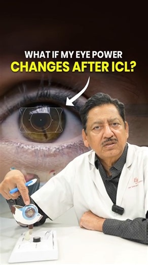 What if my eye power changes after ICL?