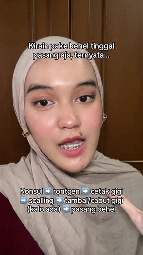 Kirain sekali dateng bisa langsung pasang behel, ternyata gak semudah itu 😌👋 #beheljourney #underbite #crossbite #orthodontics #behelgigi