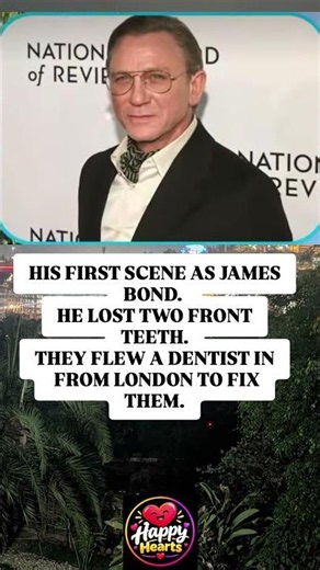 He Lost His Teeth On His First Day As Bond.