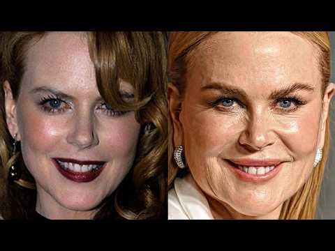 100+ Celebrities Who RUINED Their Faces With Plastic Surgery