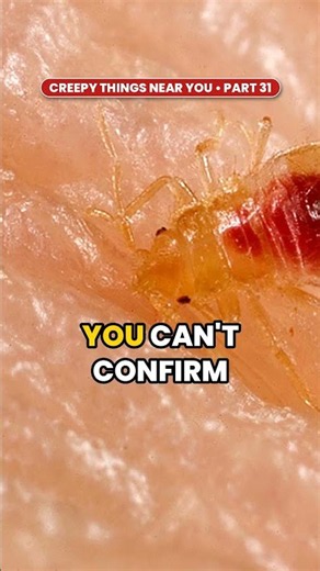 Bed Bug Bites or Flea Bites? How to Tell | Creepy Things Near You Pt. 31 #Shorts