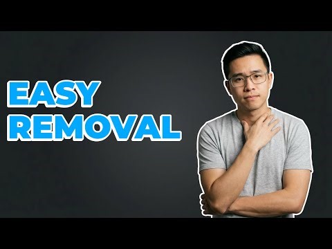 How Do I Remove the Side Panel of My PC?