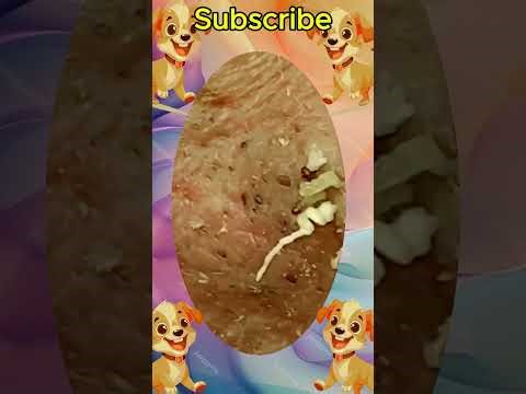 Blackheads Removal #345 | Acne Treatment and Very Satisfying Satisfying Pimple pop #blackheads