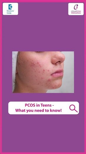 How to manage PCOS symptoms fast? With Gynaecologist Dr Ruchi Garg - Doctor's Circle