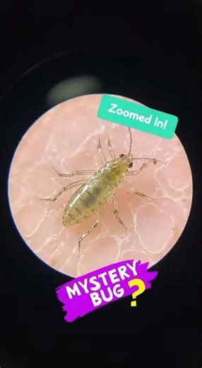Microscope Mystery: Tiny Worlds Revealed!