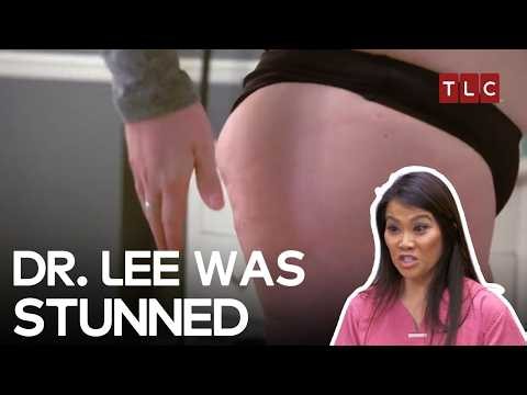 When Patients Needed Dr. Lee’s Help | Dr Pimple Popper S2 | TLC India