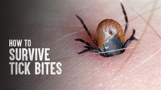 Dangerous tick encounter: How to safely remove ticks and prevent disease