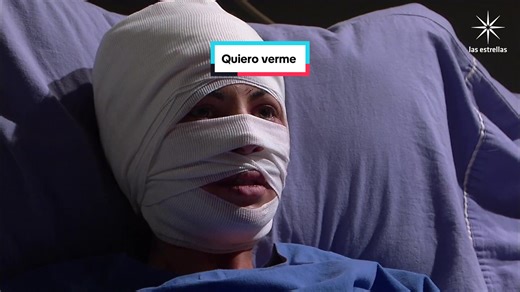 Rubí: Cómo Quedó su Cara al Final 😳😱