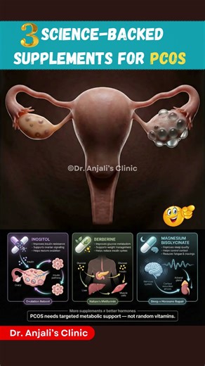 3 Best Supplements for PCOS in 2025 US Doctor Recommended 🇺🇸✅