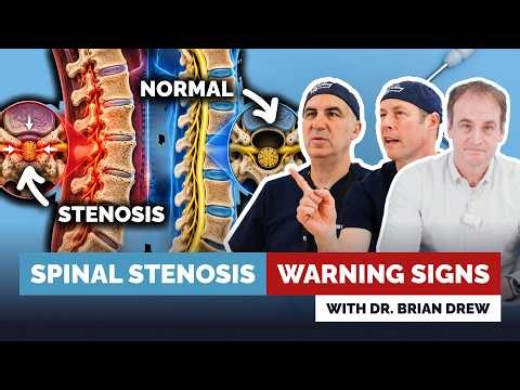 Legs Feel Sore, Heavy Or Dead? Maybe You Have Spinal Stenosis. Spine Surgeon Explains