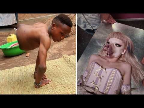 15 People Who Prove Humans Are Born to Overcome