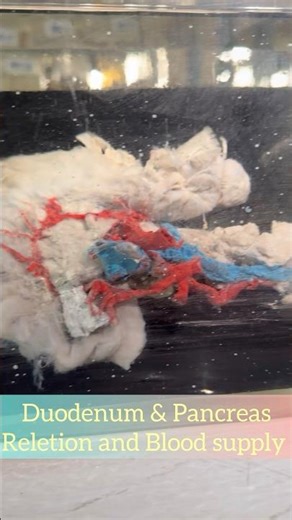 Duodenum and Pancreas Anatomy | Relations & Blood Supply | Specimen Demo #shorts