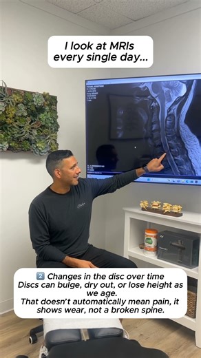 MRI results explained: What your scan really means for pain, nerves, and spine health #BackPain