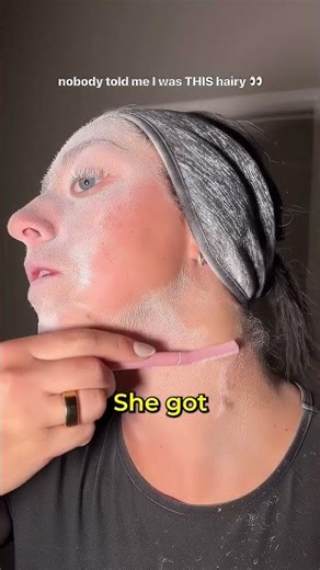 She Has a Rare Disease 🤯