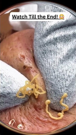 Pop Explosion! 🤯🤯🤯