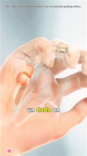 Trigger Finger Release Surgery (3D Animation)#triggerfinger #triggerfingerrelease