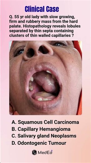 NEET PG High Yield: Deciphering the Histology Clues 📉 #pathology #fmge #nextexam #clinicalcases