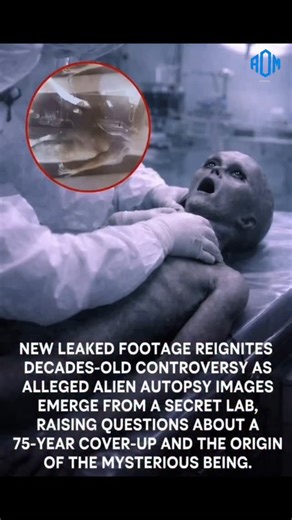 NEW LEAKED ALIEN AUTOPSY FOOTAGE LEAVES EXPERTS STUNNED! 🛑** Newly leaked footage from a “classified lab” is causing massive shock across the internet. The disturbing video allegedly shows an alien-like being undergoing a secret autopsy — images that experts claim were hidden from the public for more than 75 years. Is this real evidence? A government cover-up? Or the biggest mystery of the century finally exposed? People worldwide are demanding answers as investigators, whistleblowers, and rese