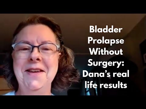 Bladder Prolapse Without Surgery: Dana's real life results