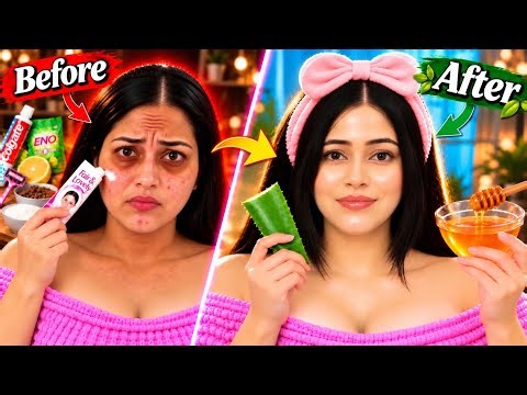 You’re Doing Skincare WRONG 😳 Remove Acne, Pigmentation, Fine lines & Get Glowing Skin | Skincare101