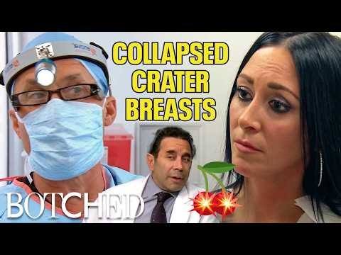"You've Been NUKED": Dana Has Craters Where Her Breasts Should Be (Before & After) | Botched | E!