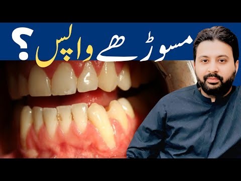 How to Regrow Receding Gums Naturally Fast | Best Home Remedies for Gum Recession | Grow Gums Back
