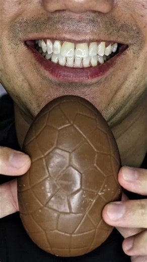 ASMR | Big KitKat Chunky Egg Bite 🍫 #DoctorTristanPeh #ASMR