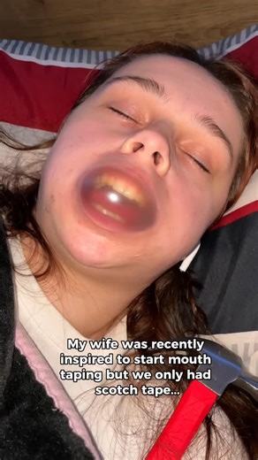 Beautiron - Beauty Store on Instagram: "Treatment of snoring"