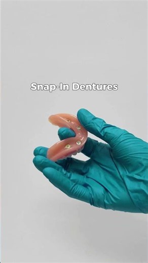 Small Upgrade = Huge Difference #snapindentures #dentures #bossiercity