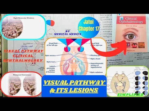 Visual Pathway & It's Lesions | Optic Nerve | Jatoi Clinical Ophthalmology Chapter 17