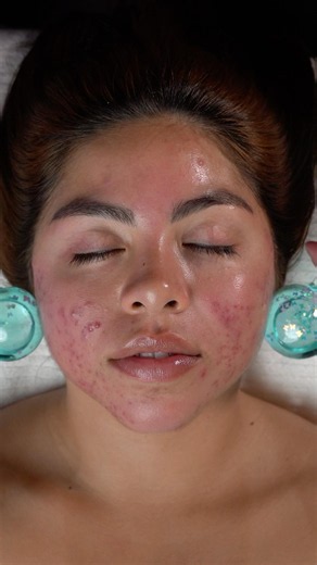 ASMR Facial