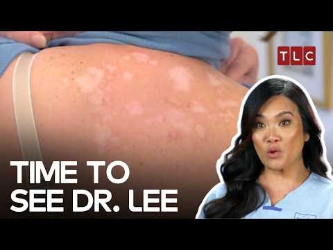 Patients Turn To Dr. Lee When They Need Help Most | Dr Pimple Popper S2, S1 & S3 | TLC India