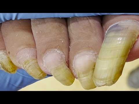 I have super long toenails, how do I wear shoes like this【Pedicure King】